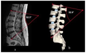 New Insights Into Biomechanics Of Lumbar Vertebrae Under Dynamic Load