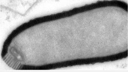 SİBİRYA'DA DONMUŞ HALDE Kİ VİRÜSLER