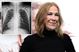 Catherine O’Hara’s Death Renews Focus On Rare Condition