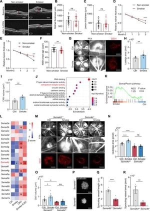 New Insights Into Smoking's Role In Age-Related Macular Degeneration