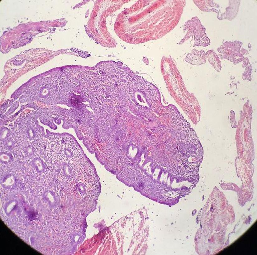 Burada gördüğünüz bir memeli hayvanın (muhtemelen insanın) rahmindeki endometriyum adı verilen mukus tabakasından alınan bir doku örneğinin mikroskop altında görüntüsüdür. Aslında her zaman bu şekilde gözükmez; ancak doku şans eseri öyle bir şekil almış ki, neredeyse tüm hatlarıyla bir dinozora, hatta spesifik olarak T. rex'e benziyor.