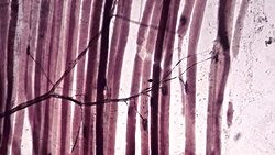 Kaslarımızda Bulunan Reseptörler Nelerdir?