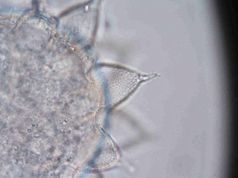 Tardigrada şubesine ait bir bireyin yumurtası.