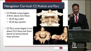 New Methods Offer Enhanced Accuracy For Pedicle Screw Placement