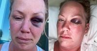 Canadian tourist reports assault at a hotel in Cuba