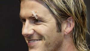 David Beckham Reflects On Pain From Past Injuries