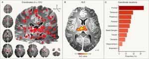 New Brain Network Identified In Idiopathic Generalized Epilepsy