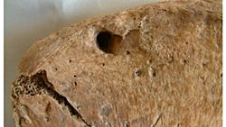 Roma Gladyatörünün Savaş Sırasında Aslan Tarafından Isırıldığına Dair İskeletsel Kanıt.