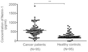 Netrin-1 Revealed As Key Factor For Cancer Prognosis And Immune Response