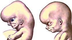 Hurda DNA İçindeki "Güçlendiriciler", Yüz Şekillerinin Belirlenmesinde Rol Oynuyor!