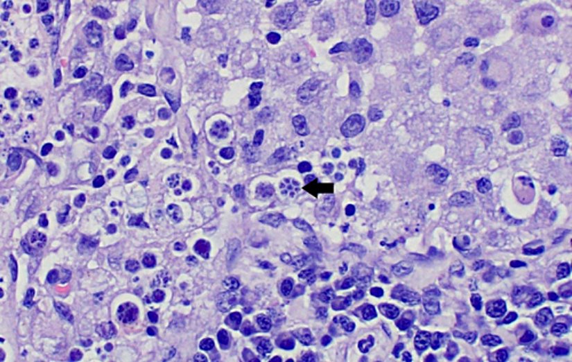 Bir köpeğin lenf nodlarından elde edilmiş histolojik kesitte Prototheca wickerhamii'nin mikroskoptaki görüntüsü. Bu tipik parçalı yapının sebebi endosporulasyon adı verilen eşeysiz üreme tipi sonucu oluşan yeni soyların tek bir hücre içinde konumlanmasıdır.