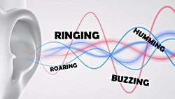 Tinnitus (Kulakda Çınlama)  Nedir ?