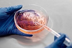 Dünyadaki bütün mikroorganizmalar (bakteri, virüs, patojen dahil) bir anda yok olsaydı ne olurdu?