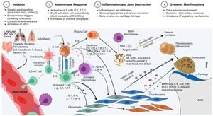 New Study Highlights Angiogenic Profiles Of Refractory Rheumatoid Arthritis