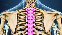 Torakal Disk Hernisi Nedir ?