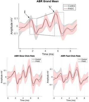 Auditory Responses And Cognitive Fatigue Linked To Long-COVID