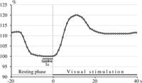 Sleep deprivation impairs neurovascular coupling and cerebral vasomotor reactivity - Scientific Reports