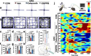 Innovative Hydrogel Alleviates Osteoarthritis Pain By Blocking Neurovascularization