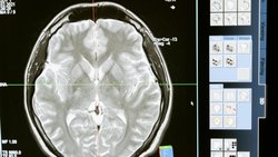 Beynin Derinliklerine Yolculuk: Nöroloji Nedir ve Neden Önemlidir?