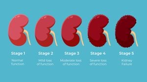 Study Reveals Oral Carbon Adsorbent Reduces Cardiovascular Risk After Dialysis