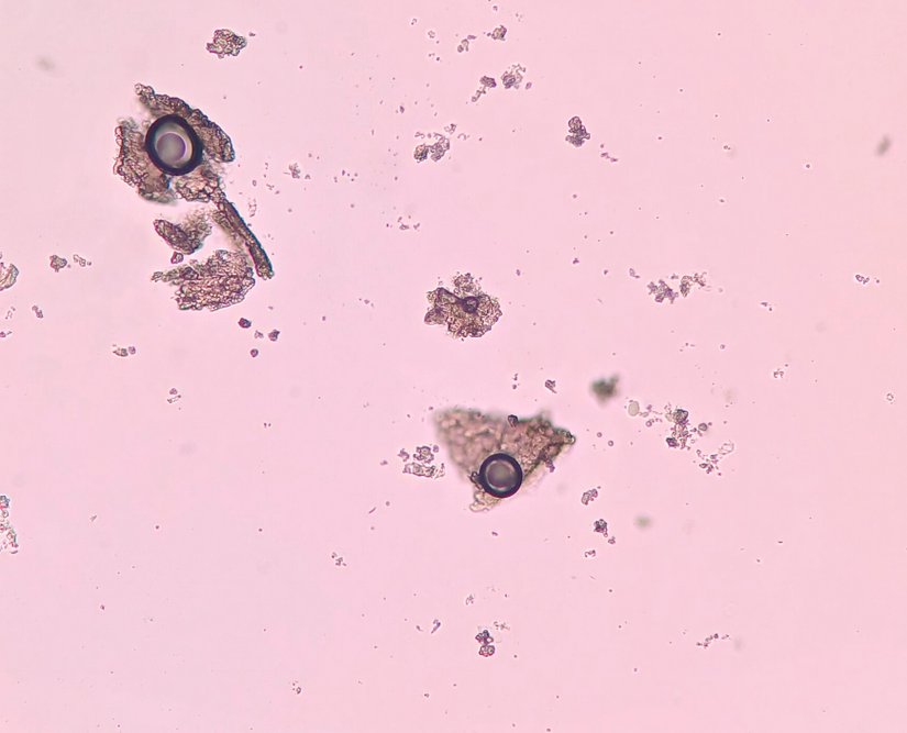 Şekil 2. Pirinç Nişastası, 400x