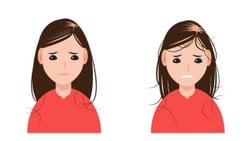 Saç Dökülmesi ve Estetik Çözümler