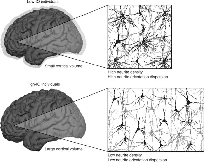Düşük ve yüksek IQ’ya sahip bireylerin nörit konfigürasyonları arasındaki yapısal farkları gösteren bir şema.