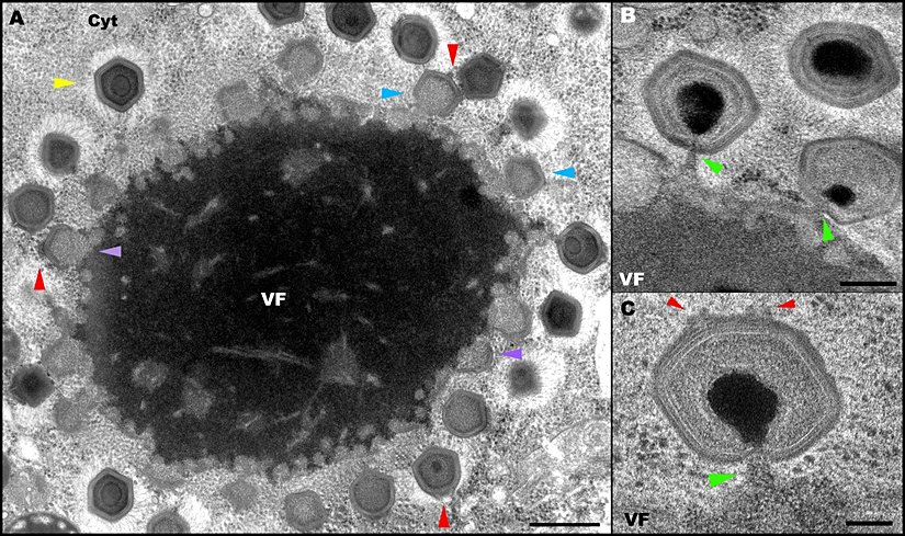 Bir dev virüs türü olan mimivirüsün oluşturduğu viral fabrikalar