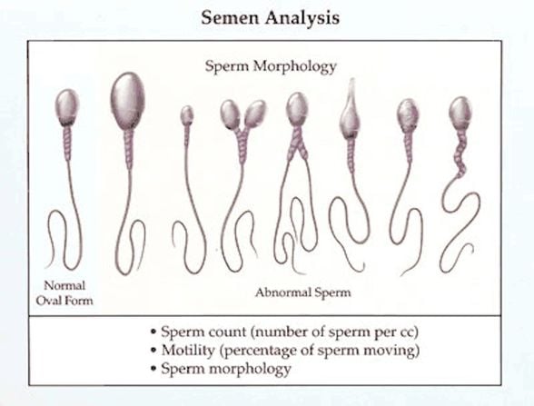 Sağlık ve saplıklık sperm şekilleri