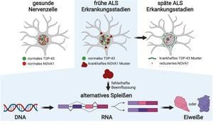 New Deep Learning Model Enhances ALS Diagnosis Accuracy