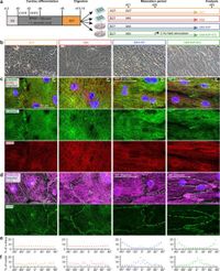 Comprehensive promotion of iPSC-CM maturation by integrating metabolic medium with nanopatterning and electrostimulation - Nature Communications