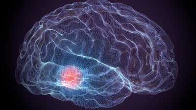 Antidepresanlar ve Kan Sulandırıcılar, Beyin Kanserine Karşı Savaşıyor!