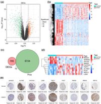 Identification of RNA processing factor LSM5 as a new adverse biomarker in nasopharyngeal carcinoma - Scientific Reports