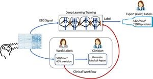 Machine Learning Framework Enhances ECT Seizure Classification