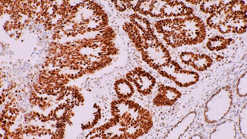 Immunohistochemistry (IHC)