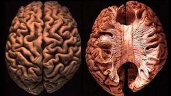 Corpus Callosum Nedir?