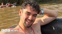 Methanol poisoning: Man saw kaleidoscopic light before going blind