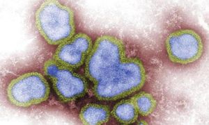 Teen Faces Critical Condition After Presumptive H5N1 Infection