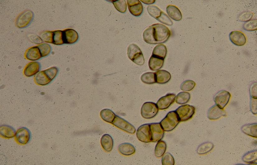 Tinea nigra'ya sebep olan Hortaea werneckii mantarı