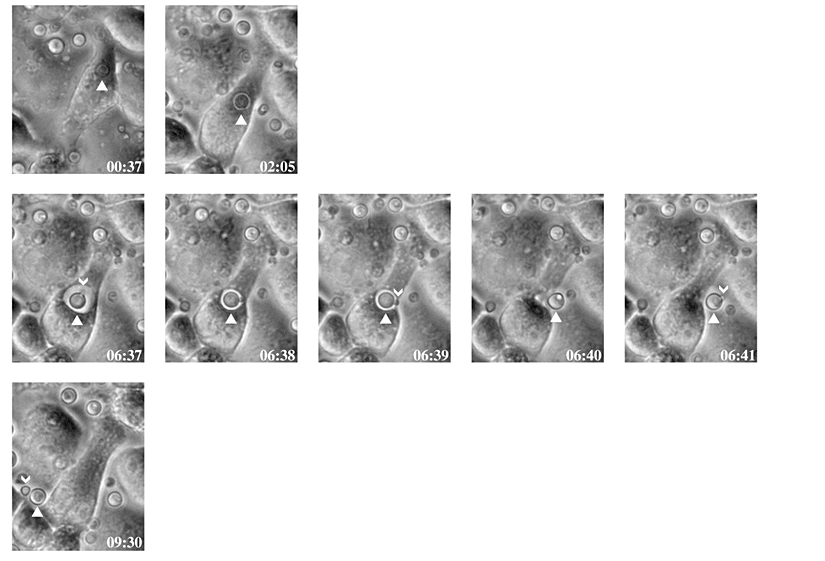 Şekil 2. Mantar hücrelerinin makrofaj dışına salınması (Ma, 2006).
