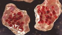 Measles health alert issued in Sydney