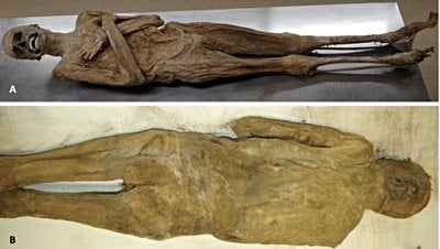 Yüzlerce Yıl Hiç Bozulmadan Kalan Avusturyalı Bir Papazın Mumyası, Yeni Bir Mumyalama Yöntemi Ortaya Çıkardı!