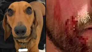 Dachshund Fatally Bites Baby Girl While She Sleeps