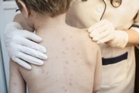 Vaccine-Preventable  Diseases Make a Comeback