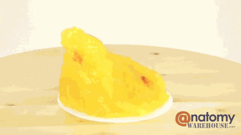 Yarım kilo insan yağının görünüşü.