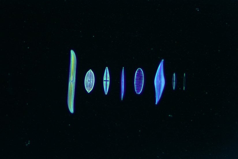 Diatomların karanlık alan mikroskobu görüntüleri (x100)