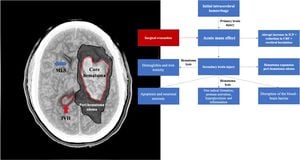 New Nomogram Predicts Mortality Risk After Traumatic Intracranial Hemorrhage Surgery