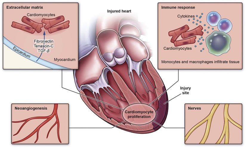kalp kaslarının yenilenmesi