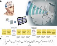 Individualized non-invasive deep brain stimulation of the basal ganglia using transcranial ultrasound stimulation - Nature Communications