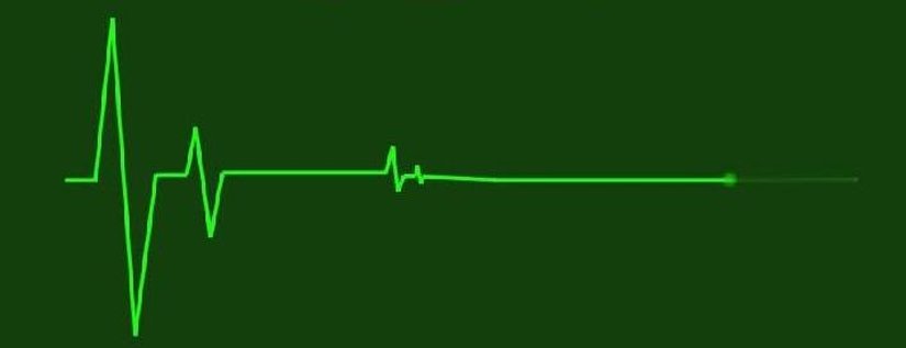 Kalp Atım Göstergeleri ve Düz Çizgiler